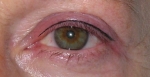 liner 17