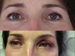 Maquillage avant et dermopigmentation après